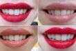 Lipstick tricks that can help your teeth look whiter - Insider