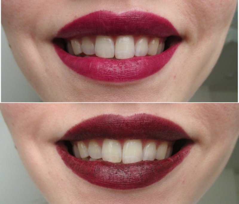 Best Lipstick Yellow Teeth